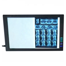 High Quality X-ray Illuminator negatoscope  LED double viewer